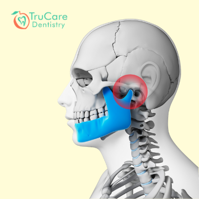 TMJ Disorder Treatment and Exercises