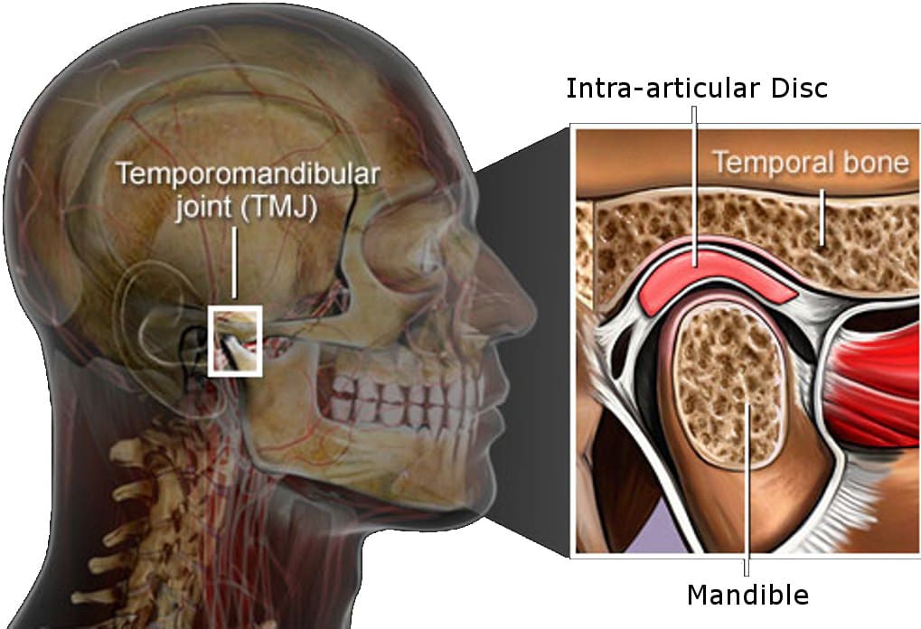 TMJ Disorder treatment Roswell GA